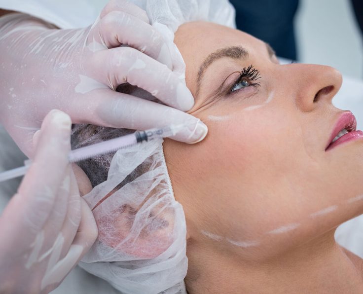 Botox
