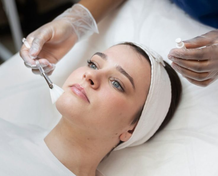 Microneedling